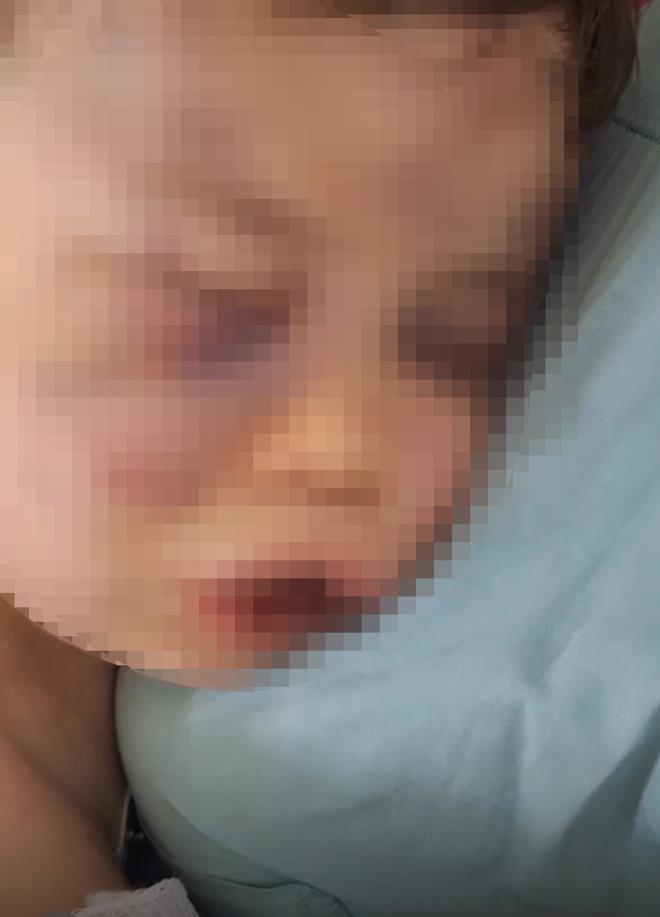 <strong>Sann Savunmas</strong><br>  Sank S.D., tutuklu bulunduu cezaevinden SEGBS araclyla durumaya katld ve Aren bebei darbetmediini savunarak beraat talep etti.