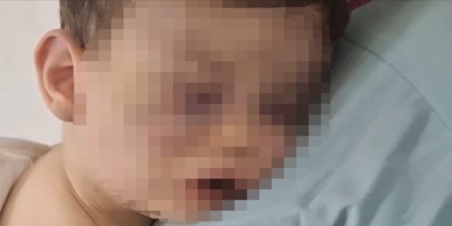 2 Yandaki Aren Bebein Darp Davasnda Yakalama Karar