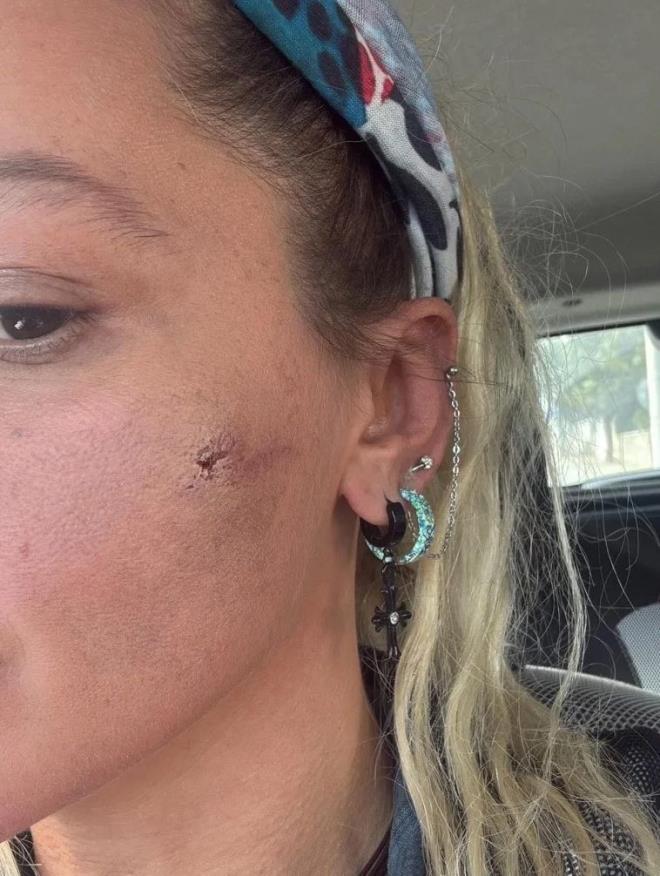 nl sanat, yaynlad fotoraflarla darp iddiasn gzler nne sererken, "Kocam tarafndan darp edildim" szleriyle yardm arsnda bulundu.