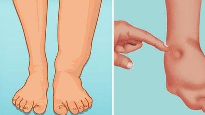 NEDEN GECE ��MEL�S�N�Z? V�cut, gece uyku s�ras�nda detoks mekanizmalar�n� (�zellikle lenf sistemini) en aktif �ekilde �al��t�r�r. Yatmadan 1 saat �nce i�ece�iniz bu kar���m, b�breklerin s�zme kapasitesini destekleyerek gece boyunca biriken sodyumu ve fazla suyu d��ar� atman�za yard�mc� olur.