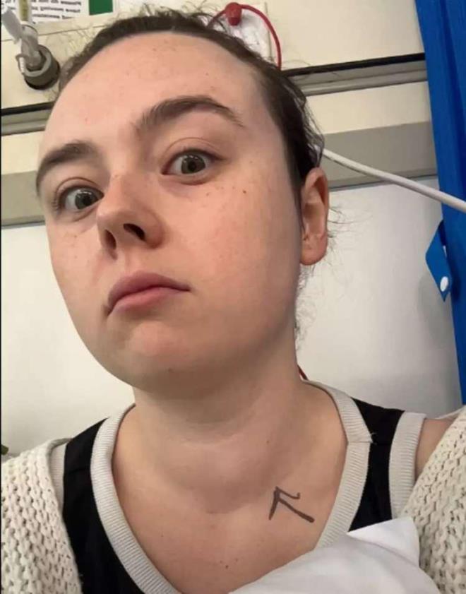 Londra'da ya�ayan Hannah Sheridan isimli gen� kad�n, arkada�lar�n�n boynunda fark etti�i anormal b�y�kl�kteki �i�li�in tiroid kanseri oldu�unu aylar sonra ��rendi. Hannah Sheridan, ilk kez arkada�lar�yla birlikte e�lenirken fark etti�i bu �i�li�i ba�ta �nemsemedi ve bunun ciddi bir �ey olabilece�i hi� akl�na gelmedi.