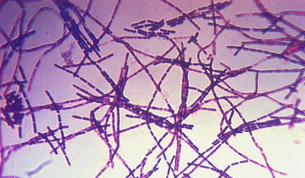 arbon 55 milyon 52 bin 999'da bir