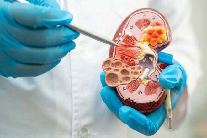 B�brek ta�� olan ki�ilerde yeterli su i�mesinin �ok �nemli oldu�unu belirten ��men, <em><strong>"Ancak kalp yetmezli�i, ileri b�brek hastal��� veya karaci�er sirozu olan hastalarda fazla su i�mek, v�cutta su toplanmas�na, nefes darl���na ve hastaneye yat��lara neden olabilir.&nbsp;Bu hastalarda su miktar� mutlaka doktor taraf�ndan bireysel olarak de�erlendirilip belirlenmelidir"</strong></em> ifadelerini kulland�.