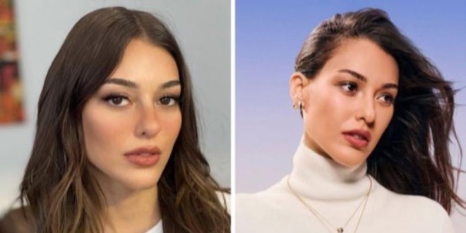 Y�z�ndeki de�i�im olay oldu! G�renler tan�yamad�