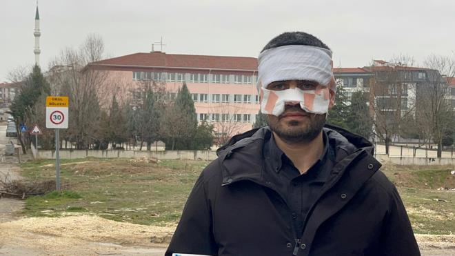 <span data-path-to-node="5,4,2,0"><b data-path-to-node="5,4,2,0" data-index-in-node="0">Tedavisi S�r�yor:</b> G�z kapaklar� ve aln� yanan ��retmen, "Allah'tan g�zlerimi kapatm���m" diyerek ya�ad��� �oku anlatt�.</span>