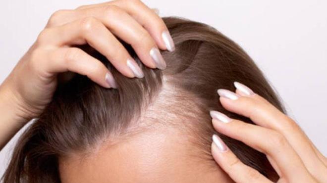 Saf u�ucu ya�lar�n do�rudan sa�l� deriye uygulanmas� her zaman do�ru bir y�ntem de�il. U�ucu ya�lar olduk�a konsantre oldu�u i�in tahri�e neden olabiliyor. Bu nedenle uzmanlar seyreltilmi� kullan�m �neriyor. Pratik bir y�ntem olarak g�nl�k kulland���n�z �ampuan�n i�ine her y�kamada bir damla biberiye ya�� ekleyebilirsiniz.