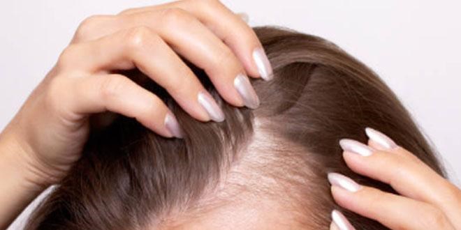 Sa� k�klerine i�liyor, adeta kelli�in �aresi!