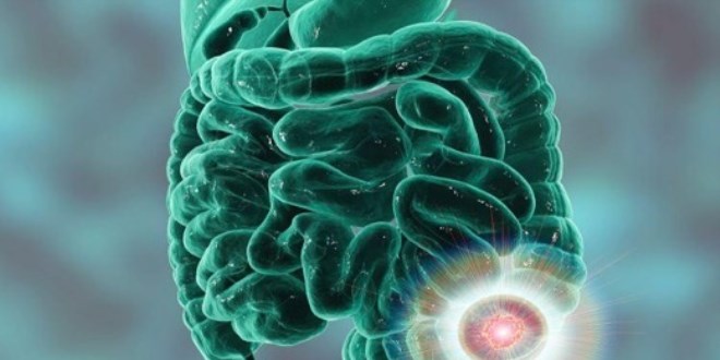 Ramazan ay�nda ba��rsak temizli�i nas�l yap�l�r?