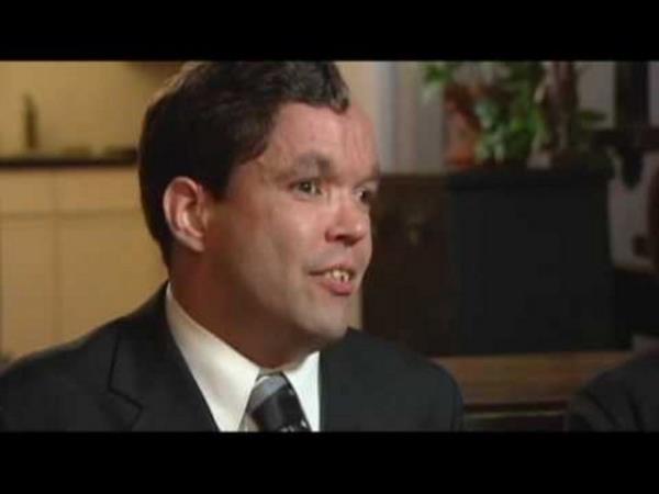 Wall daha 18 aylkken doktorlar kalbinin yerini deitirmeye altlar ve tan 15 ameliyat yaptlar. Fakat bunun ok byk riskler tad grld ve bundan vazgeilerek kalbin bulunduu blm daha kaln bir deriyle kapland.