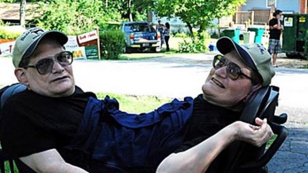 Kollar, bacaklar, mideleri, cierleri ve kalpleri ayrlan ikizlerin tek bir barsa ve tek bir reme organ bulunuyor.