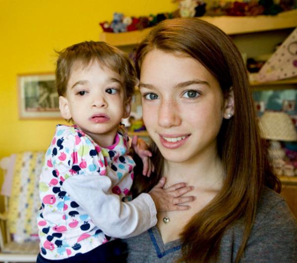 Brooke?un drt yandan beri sadece salar ve trnaklar uzuyor. Byme hormonu kesinlikle etki etmiyor ve bilim adamlar uzun sreden bu hastala are bulmaya alyor. Ailesi ise artk Brooke?un bir bebek gibi olduunu kabul etmi durumda.