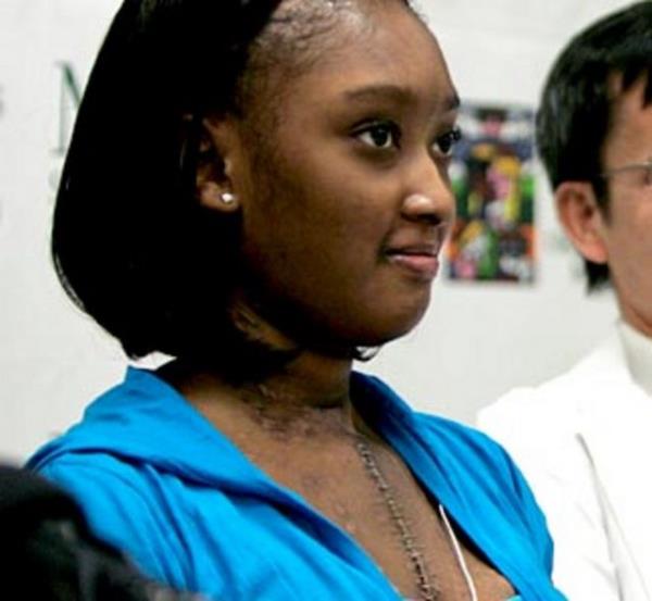 Doktorlar bu yeni organ karmak zorunda kald, ancak yeni bir kalp olmad ve D'Zhana ameliyattan sonra gszletii iin geici bir nlem alnmas gerekti. 4 ay boyunca iki yapay pompa vcudundaki kan akn gerekletirdi. En sonunda 29 Ekim gn yeni bir kalp nakli yapld. Nakil o kadar baarl oldu ki D'Zhana'ya hemen ertesi gn bir de bbrek nakli yapld.