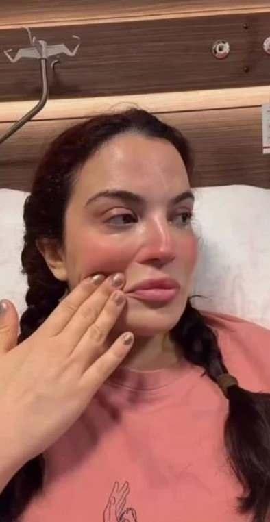 Bekiro�lu, kat�ld��� bir programda ya�ad�klar�n�; "Sonra 6-7 ay kadar bekledik; en son Ekim ay�nda bir ameliyat daha oldum. Bu sefer kas�m� ald�lar ve a�a��ya koydular, aray� kapats�n diye. Tam tutmad�. �imdi de baca��m� kesip i�eri koyacaklar. �ki ameliyat�m daha olacak; biri Ocak'ta, di�eri Mart-Nisan gibi, in�allah." s�zleriyle a��klam��t�.&nbsp;