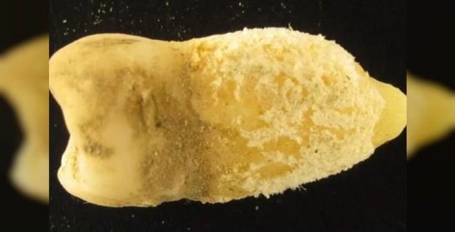 <p><span><strong>AND DA�LARI'NDAN G�N�M�ZE ULA�TI</strong></span></p>    <p><strong>Bu antik varyant�n di�er soylardan yakla��k 10.000 y�l �nce ayr�ld���n� ortaya ��karan analizler, insanlar�n And Da�lar�'na yerle�ti�i ilk d�nemlere i�aret ediyor. Yani insano�lu bu �l�mc�l patojeni ya ta��d� ya da vah�i hayvanlarla temas etmesi sonucu ortaya ��kt�.</strong></p>