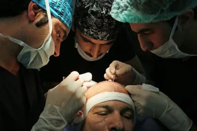 �zellikle baz� b�lgelerde, erkeklerin b�y�k bir k�sm� gen� ya�lardan itibaren sa� d�k�lmesiyle kar�� kar��ya kal�yor.