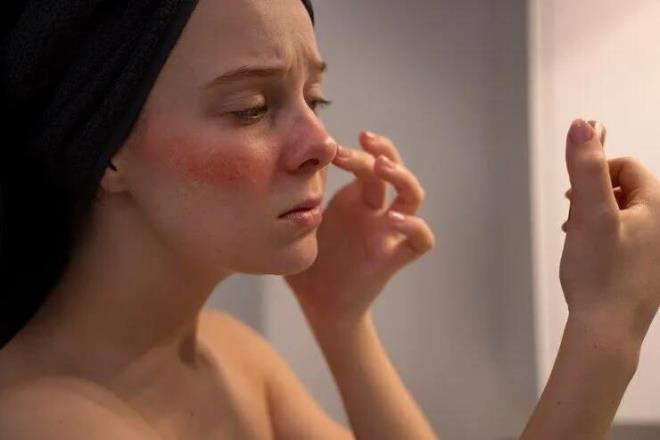 Normalde insan cildinde d���k yo�unlukta bulunan Demodex isimli mikroskobik akarlar�n baz� hastalarda rozasean�n geli�imine ve alevlenmesine katk�da bulunabilece�ini ifade eden Uzm. Dr. Tatar, <em><strong>"Demodex yo�unlu�unun artmas� deri bariyerinde bozulmaya ve ba����kl�k sisteminin uyar�lmas�na katk� sa�layabilir. Bunun sonucunda y�zde k�zar�kl�k, yanma, batma, ka��nt� ve hassasiyet geli�ebilir. Ancak Demodex tek ba��na rozasean�n nedeni de�ildir"</strong></em> dedi.