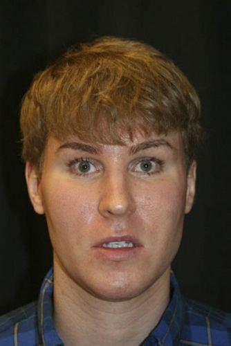 Hayatn ark sz yazarak kazanan Sheldon, Bieber'a benzeyebilmek iin geirdii ameliyatlara toplamda 100 bin dolar harcad.