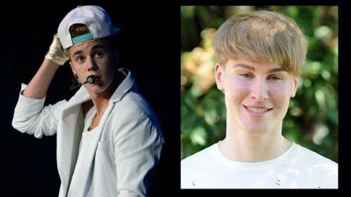ABD'nin Kaliforniya eyaletinde yaayan Toby Sheldon, tm birikimini Justin Bieber'a benzemek iin geirdii estetik ameliyatlara harcad.