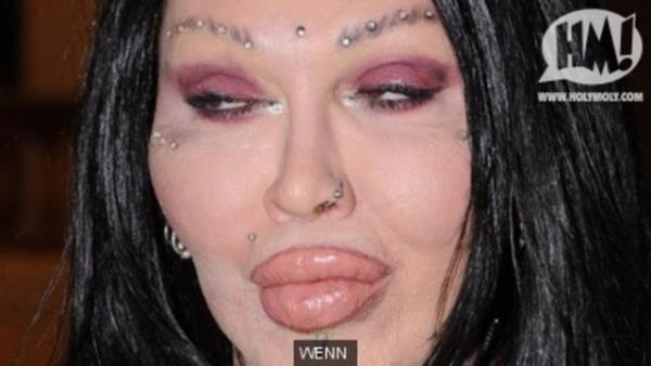 Pete Burns