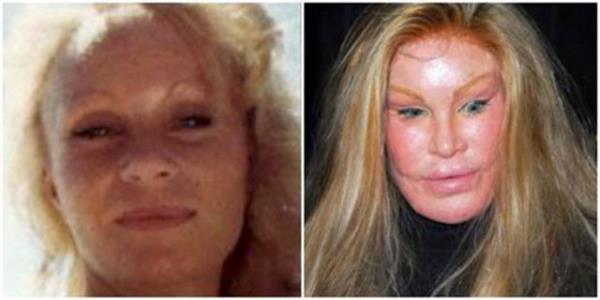 <p><b>TE ESTETK MERAKININ PMAN ETT NLLER</b></p>   Jocelyn Wldentstein