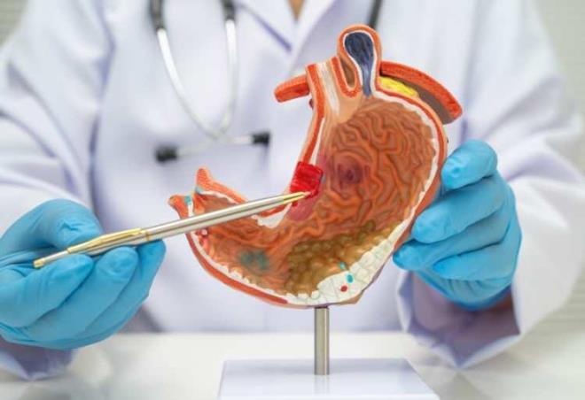 �ekerli i�eceklerin mide kanserine nas�l yol a�abilece�i mekanizmas� hen�z kesinle�memi� olsa da ara�t�rmac�lar; kilo al�m�, ins�lin direnci, steroid hormonu dengesizli�i, iltihaplanma, DNA hasar� ve ba��rsak mikrobiyotas� bozukluklar� gibi fakt�rlerin rol oynayabilece�ini de�erlendiriyor.&nbsp;