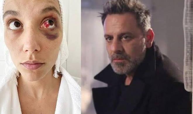 Ozan G�ven eski sevgilisi Deniz Bulutsuz’u darbetti�i gerek�esiyle yarg�land��� ve “kasten yaralama” su�undan 2 y�l 3 ay hapis cezas� ald��� dava s�recinin ailesi �zerindeki etkisini anlatt�.
