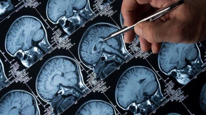 Alzheimer’� kesin olarak �nleyen bir y�ntemin bulunmad���n� ancak riskin azalt�lmas� ve hastal���n ortaya ��k���n�n geciktirilmesinin m�mk�n oldu�unu belirten G�mceli; haftada en az 150 dakika orta �iddette fiziksel aktivite yap�lmas�, Akdeniz veya DASH tipi beslenme d�zeninin benimsenmesi, tansiyon, kan �ekeri ve kolesterol�n kontrol alt�nda tutulmas�, sosyal ve zihinsel aktivitelerin s�rd�r�lmesi, i�itme ve g�rme sorunlar�n�n ihmal edilmemesi, sigara ve a��r� alkolden uzak durulmas�, kaliteli uyku ve stres y�netimine dikkat edilmesi ve kafa travmalar�ndan korunulmas� �nerilerinde bulundu.