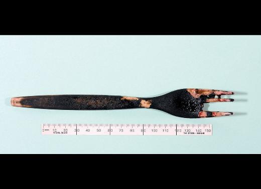 Lee Gardner yuttuu plastik atalla 10 yl boyunca birlikte yaamt. te baarl bir operasyonla karlan o atal.