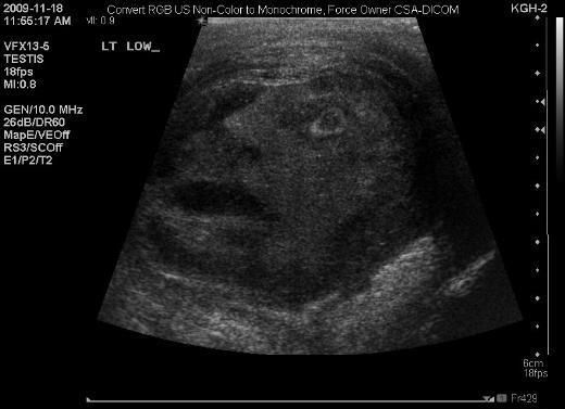 Kanada'da ekilen bu ultrason grnts, grenleri oke ediyor. Bir erkein testis kanseri olup olmad tespit etmek isteyen doktorlar, ultrason yntemine bavurdu. Ortaya ise sanki lk atan erkei andran bu grnt kt.