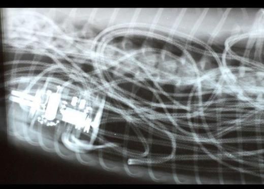  buuk metre uzunluundaki bir piton ylan olan Houdini, sahibi tarafndan scak olsun diye kafesine konulan elektrikli battaniyeyi yutunca, battaniyenin iindeki tesisat iinde skp kald. Ylan, baarl bir operasyonla eski haline geri dnd.