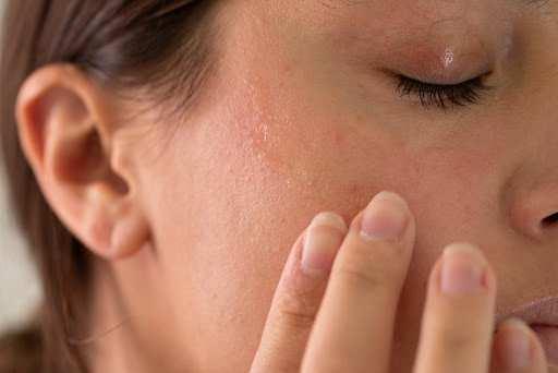 Medical Point Gaziantep Hastanesi Dermatoloji Uzman� Dr. Halil �brahim Gazio�lu, sonbahar aylar�nda cildin �evresel de�i�ikliklere kar�� daha hassas hale gelebildi�ini belirterek baz� �nlemler al�nmas� gerekti�ini belirtti.