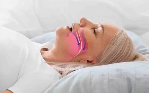 <p><strong>UYKU TEST� YAPILMASI GEREK�R</strong></p>    <p>&nbsp;</p>    <p>&nbsp;</p>    <p>Horlama �ik�yetiyle ba�vuran hastalarda �ncelikle ayr�nt�l� �yk� al�nmas� gerekti�ini belirtem Dr. Oymak daha sonra kulak burun bo�az muayenesi yap�lmas� gerekti�ini belirtti.</p>