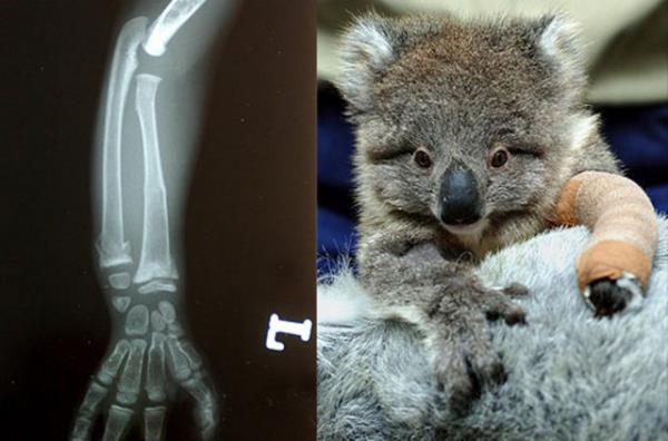 Avusturalya'da yaayan bu sevimli Koalo'ya araba arpt ama kurtuldu. Melbourne Hayvan Merkezi'ne gtrlen Koalo'nun ekilen rntgen filminde kolunun krld farkedildi.