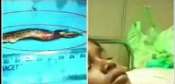 Baln srekli hareket etmesi nedeniyle nefes almakta glk yaamaya balayan ocuun kanndaki oksijen orannn da ciddi oranda d gstermesi sonucunda ocuk x-ray cihazndan geirildi.