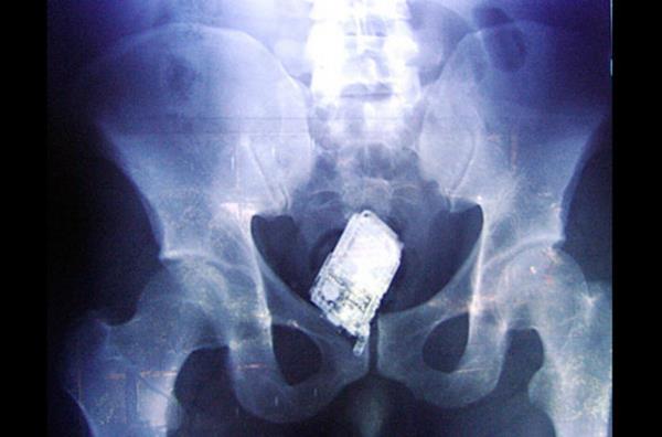 Bu karede ise Salvadoran Hapishanesi'nde yaplan aramada mahkumlarn vucutlarna gizledikleri cep telefonu gzkyor.