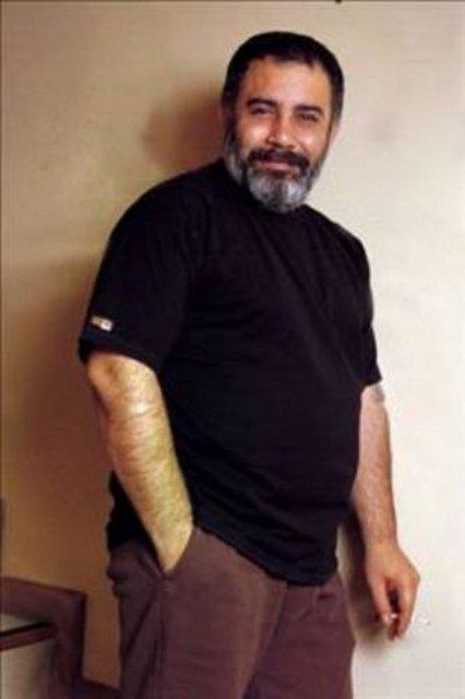 BU ALBMLERDE EN OK, E GLTEN KAYA'NIN ABS, KENDSNN DE YOL ARKADAI OLAN YUSUF HAYALOLU'NUN RLERN BESTED.