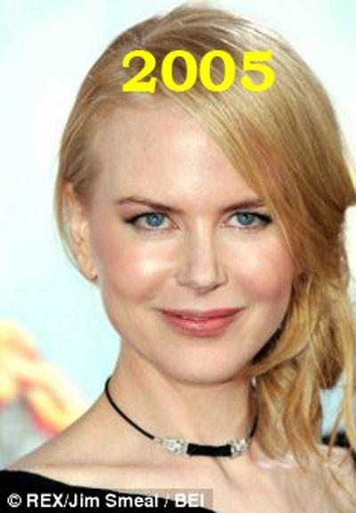 Hollywood'un en gzel aktristlerinden Nicole Kidman'n 20 yllk deiimi haber oldu.