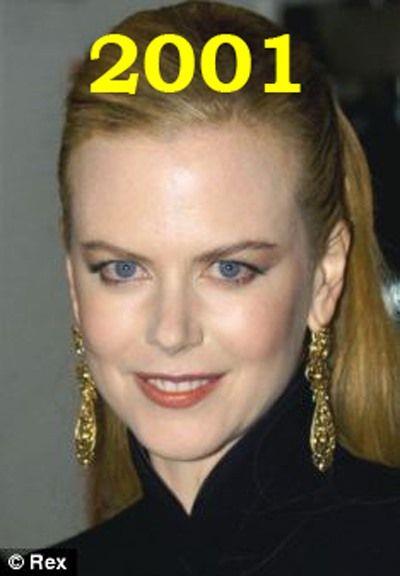 Hollywood'un en gzel aktristlerinden Nicole Kidman'n 20 yllk deiimi haber oldu.