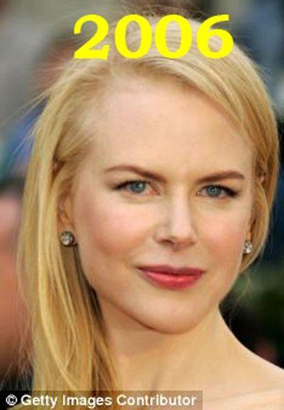 Hollywood'un en gzel aktristlerinden Nicole Kidman'n 20 yllk deiimi haber oldu.