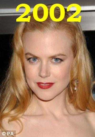 Hollywood'un en gzel aktristlerinden Nicole Kidman'n 20 yllk deiimi haber oldu.