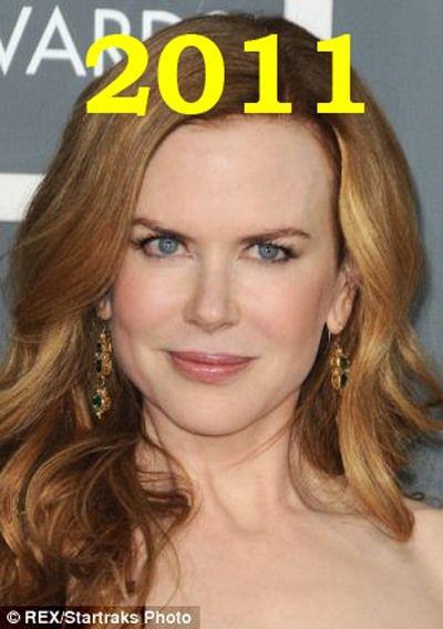 Hollywood'un en gzel aktristlerinden Nicole Kidman'n 20 yllk deiimi haber oldu.