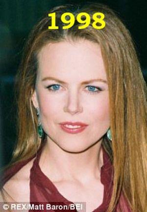 Hollywood'un en gzel aktristlerinden Nicole Kidman'n 20 yllk deiimi haber oldu.