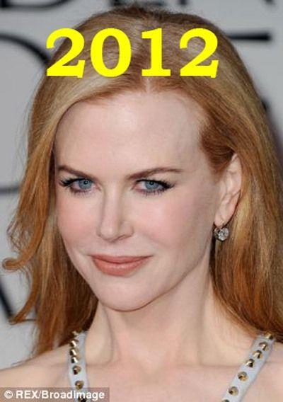 Hollywood'un en gzel aktristlerinden Nicole Kidman'n 20 yllk deiimi haber oldu.