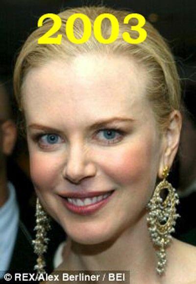 Hollywood'un en gzel aktristlerinden Nicole Kidman'n 20 yllk deiimi haber oldu.