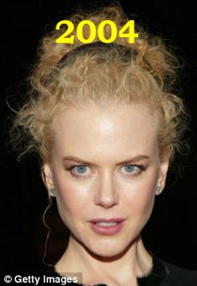 Hollywood'un en gzel aktristlerinden Nicole Kidman'n 20 yllk deiimi haber oldu.