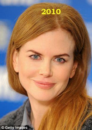 Hollywood'un en gzel aktristlerinden Nicole Kidman'n 20 yllk deiimi haber oldu.