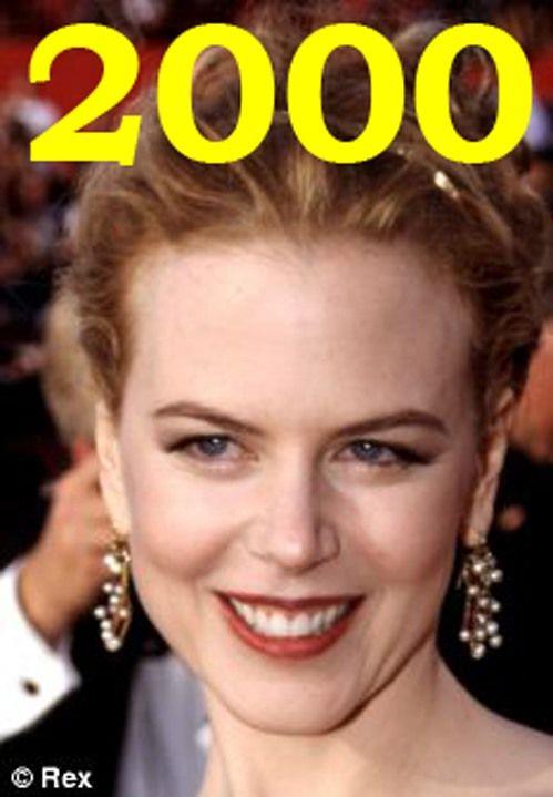 Hollywood'un en gzel aktristlerinden Nicole Kidman'n 20 yllk deiimi haber oldu.