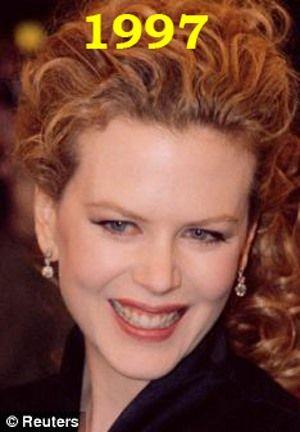 Hollywood'un en gzel aktristlerinden Nicole Kidman'n 20 yllk deiimi haber oldu.