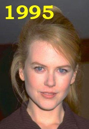 Hollywood'un en gzel aktristlerinden Nicole Kidman'n 20 yllk deiimi haber oldu.