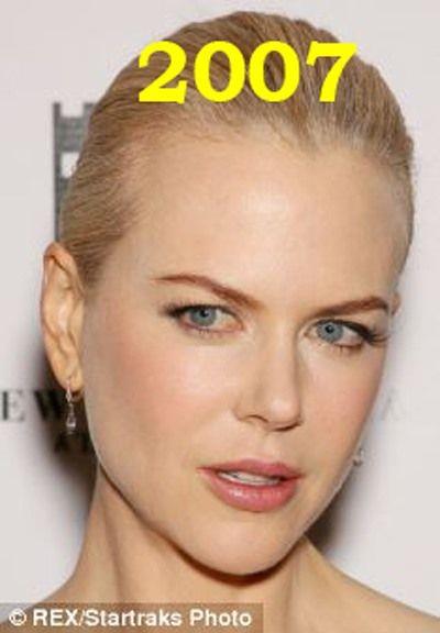 Hollywood'un en gzel aktristlerinden Nicole Kidman'n 20 yllk deiimi haber oldu.